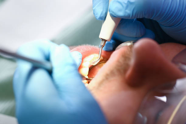 Best Emergency Treatment for Toothache in Stonewood, WV